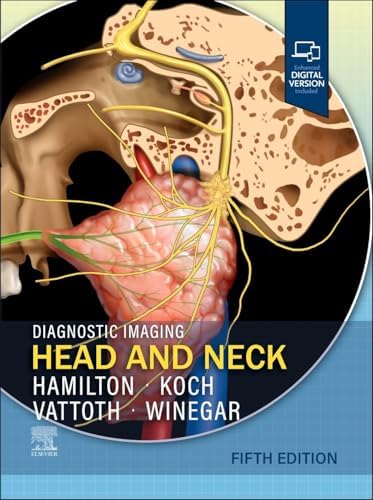 Diagnostic Imaging: Brain: 9780443380198: Medicine & Health